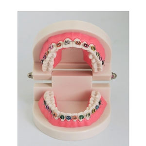 Modelo de dientes de ortodoncia dental con soporte de metal - Product Image 5