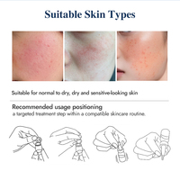 Poudre lyophilisée personnalisée Cica pour une peau plus éclatante, hydratante, qui soutient la barrière cutanée, apaise la peau et atténue les taches