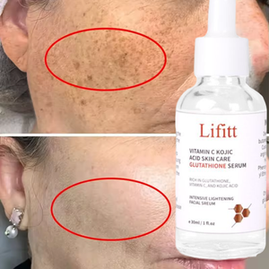 Veganer organischer Kollagen-Retinol-Serum-Hyper pigmentierung entferner mit klinischer Stärke für Anti-Aging-OEM/ODM auf Gesichts basis - Product Image 2