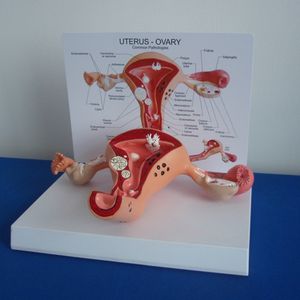 Geavanceerde pvc Vrouwelijke Interne Genitale orgel anatomisch Model - Product Image 2