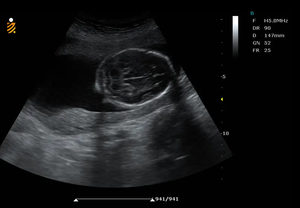 Mesin <span class=keywords><strong>Ultrasound</strong></span> Doppler warna berbasis troli baru 2024 untuk rumah sakit pemindai gema 15 inci - Product Image 6