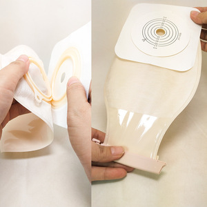 Bolsa de proctostomía Aibeze de dos piezas, tipo abierto, para el cuidado de fístulas, dispositivo médico - Product Image 4