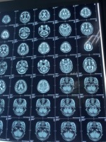 Impresora de Película Térmica para Rayos X para Película de Rayos X Médica y No Médica Fuji