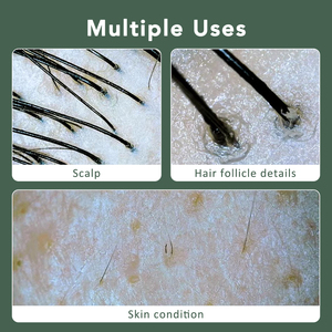 多機能ビジュアルポアテストデバイスポータブルHDスカルプスキャナー検出器毛包スキンアナライザーカメラ付き - Product Image 2