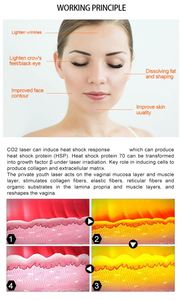 Système laser CO2 de bureau pour soins esthétiques - Modes pulsés simples/continus, écran LCD et rayon de travail de 110 cm pour salon - Product Image 6