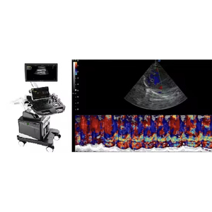Scanner à ultrasons numérique Doppler intelligent avec sonde microconvexe pour usage vétérinaire - Product Image 6