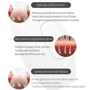 Depiladora IPL Mini <span class=keywords><strong>Kenzzi</strong></span> Aprobada por la FDA, Depilación Láser IPL Permanente para Uso Doméstico - Product Image 5