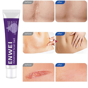 Gel de suppression des cicatrices à base de plantes ENWEI EW017, action rapide, réparation de la peau, pour hommes, femmes, adolescents, acné, chirurgie, vergetures, soin quotidien de la peau - Product Image 6