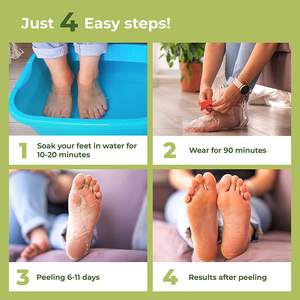 Maschera Peeling per <span class=keywords><strong>piedi</strong></span> alla fragola maschera per la rimozione della pelle morta per la riparazione del tallone incrinato per i <span class=keywords><strong>piedi</strong></span> morbidi del bambino - Product Image 5