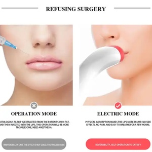 Voluminizador de Labios Eléctrico Recargable por USB, Portátil, para Uso en Salones de Belleza, Equipo para Aumentar el Volumen de Labios - Product Image 3