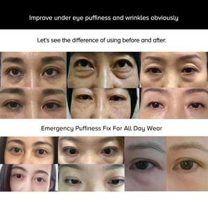Crema de Ojos Reafirmante y Lifting Instantáneo, Reduce Arrugas y Bolsas, en Envase de Jeringa Airless, Efecto Antiedad en 2 Minutos - Product Image 5