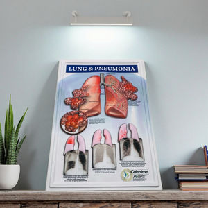 Lo studente umano i polmoni che insegna <span class=keywords><strong>3D</strong></span> Poster medico personalizzato Poster murale - Product Image 1