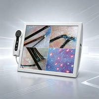 Home Use Skin Analyzer Home Hot Sales Portable 4-Spectrum Scalp Analysis Hair Analyzer Machine