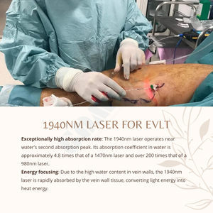 Máquina Láser de Diodo de 1940nm al por Mayor para Eliminación Vascular, Tratamiento de Arañas Vasculares y Dispositivo Profesional de Rejuvenecimiento de la Piel - Product Image 3