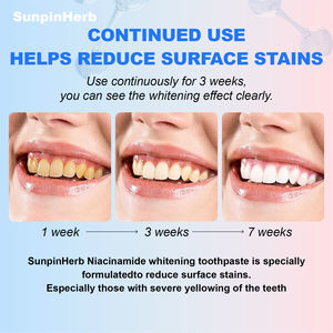 Pasta Dental Blanqueadora Orgánica Sin Flúor, Probióticos, Nicotinamida, Anti-Caries, Anti-Placa, Cuidado Bucal para Adultos, Limpieza Profunda, Uso Doméstico - Product Image 5