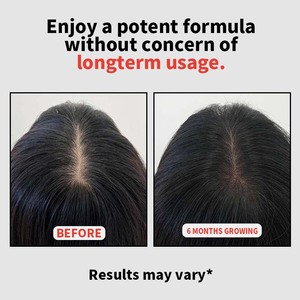 Factory <strong>Direct</strong> Hair Growth Supplement Tablets Custom Private Label <strong>Vitamins</strong> For Natural <strong>and</strong> Nutritional Hair Restoration - Product Image 5