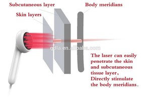 Cầm tay Pet vật lý trị liệu Laser lạnh da Heath Doanh chấn thương chữa bệnh điều trị cho động vật đau - Product Image 2