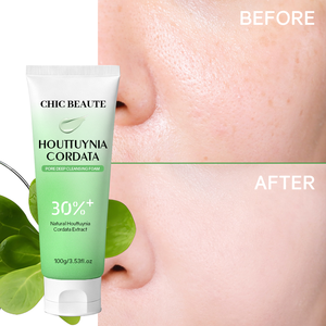 CHIC BEAUTE - <span class=keywords><strong>Limpiador</strong></span> Facial Vegano Hidratante y Blanqueador, Espuma Limpiadora Profunda que Ilumina la Piel, <span class=keywords><strong>Limpiador</strong></span> Facial con Houttuynia Cordata - Product Image 3