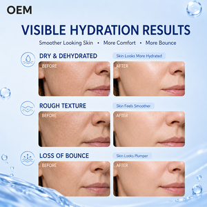 Crème Visage Hydratante B5 Capsule Bleue Prix Usine PDRN <span class=keywords><strong>Acide</strong></span> <span class=keywords><strong>Hyaluronique</strong></span> Rajeunissante Réparatrice Cosmétique Premium Vente en Gros Export - Product Image 4