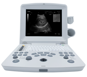 Appareil d'échographie <span class=keywords><strong>Edan</strong></span> DUS60 Dooplee Couleur <span class=keywords><strong>Portable</strong></span> pour animaux de compagnie - Product Image 2