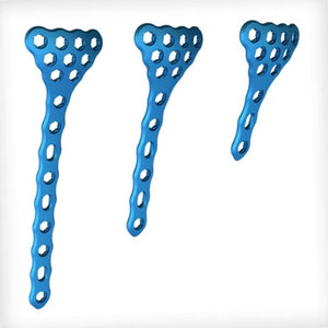 Implantes Ortopédicos de Titanio de Nuevo Diseño en Oferta, Placa para Radio Distal y Únula, Placa Ósea de Ángulo Variable, Implantes Ortopédicos Reutilizables - Product Image 5