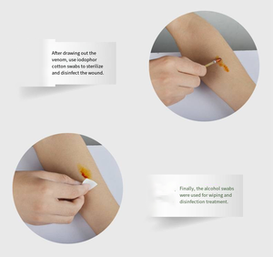 Dispositivo <span class=keywords><strong>de</strong></span> succión <span class=keywords><strong>de</strong></span> veneno <span class=keywords><strong>de</strong></span> mano para seguridad al aire libre Alivia las picaduras <span class=keywords><strong>de</strong></span> insectos, picaduras <span class=keywords><strong>de</strong></span> avispas rápidas - Product Image 6