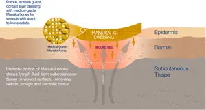 Polyzon विज्ञान अच्छी तरह से देखभाल Manuka शहद घाव ड्रेसिंग Manuka शहद धुंध ड्रेसिंग