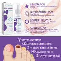 JAYSUING Produits Traitement Mycose Ongles 7 Jours Spray 100ml