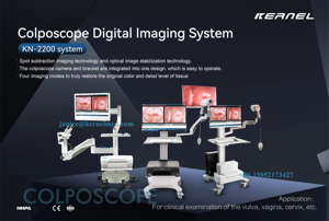 Kernel High-Accuracy Colposcopy Equipment for <strong>Womens</strong> Health Clinics Optical <strong>Colposcope</strong> KN-2200B 32X Optical Zoom LED - Product Image 5