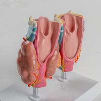 Modèle d'anatomie pathologique thyroïdienne médicale pour l'enseignement et la démonstration