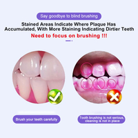 Stylo effaceur de taches dentaires pour usage domestique, avec identificateur de taches et pâte de polissage pour les dents