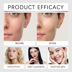 Sérum Éclaircissant Anti-Taches pour le Visage en Gros : Niacinamide et Acide Tranexamique pour un Teint Unifié - Product Image 6