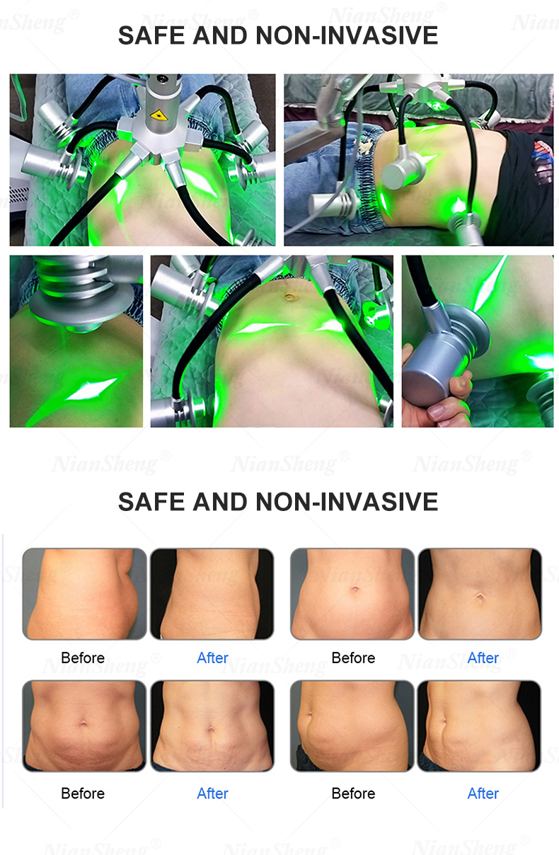 6D lipo Laser Non-invasive 532nm Laser Green Red light Cold Fat Removal Cellulite Removal Body Shaping weight loss Laser Machine