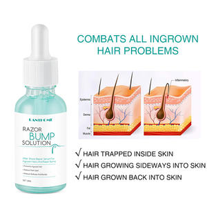 Cheveux de marque privée prévenant les bosses sérum <span class=keywords><strong>anti</strong></span>-acné <span class=keywords><strong>anti</strong></span>-rougeurs taches brunes réduisant la peau morte rasoir exfoliant solution des bosses - Product Image 4