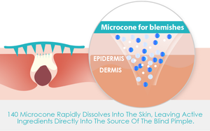 Anti-Aging anti-kırışıklık göz alanı altında en kaliteli göz maskesi mikro-iğne göz yamaları - Product Image 4