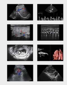 अनुकूल मानक 21.5 इंच मॉनिटर ट्रॉली रंग डॉपलर अल्ट्रासाउंड - Product Image 2