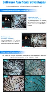 AU-DS3 High Definition Hair Scalp Diagnostic Equipment Intelligent Follicle Detector Machine - Product Image 2