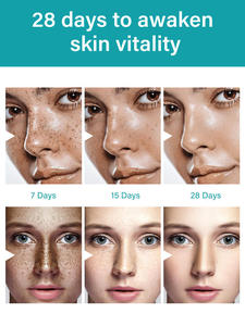 Crema para el Cuidado de la Piel OEM/ODM para Eliminar Manchas Oscuras, Pecas, <span class=keywords><strong>Melasma</strong></span>, Acné, Blanqueadora, Contiene Arbutina, Ceramida y Ácido Kójico - Product Image 5