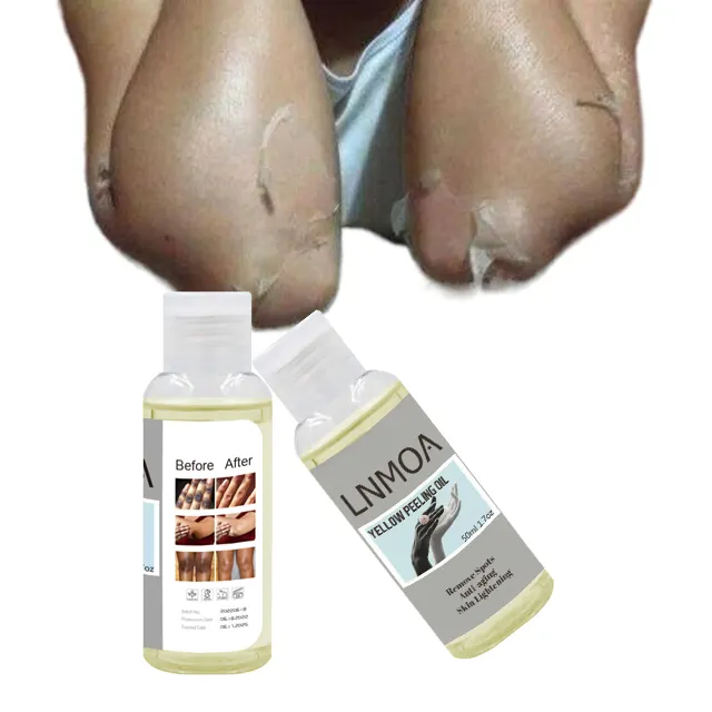 Dark knees & elbows peeling oil yellow the latest strong peeling oil For all skin types peeling oil whitening