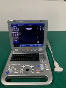 Máquina de Ultrasonido Portátil Profesional Pw Doppler USG 2D 3D al Mejor Precio - Product Image 2