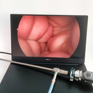4k FHD y tế hysteroscopy Máy cứng nhắc cystoscope <span class=keywords><strong>urethroscope</strong></span> artroscopy nội soi khớp nội soi Hệ thống <span class=keywords><strong>camera</strong></span> - Product Image 3
