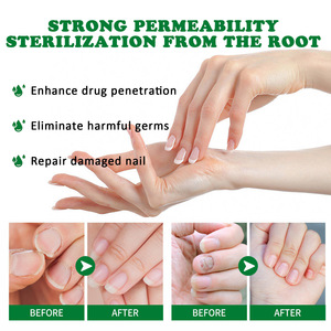 Líquido para el Cuidado de las Uñas con Jengibre, Hidratante Suave, Suavizante para Uñas Gruesas, Abrillantador, Tratamiento para Hongos <span class=keywords><strong>en</strong></span> las Uñas de <span class=keywords><strong>Manos</strong></span> y Pies, Venta al Por Mayor - Product Image 2