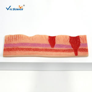 Model perforasi lambung dan perforasi lambung - Product Image 3