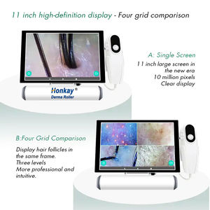 Noticias Productos 2024 Analizador de piel del cabello Analizador de cabello y piel Dispositivo analizador de cabello Máquina de análisis de piel Equipo de salón de belleza - Product Image 3