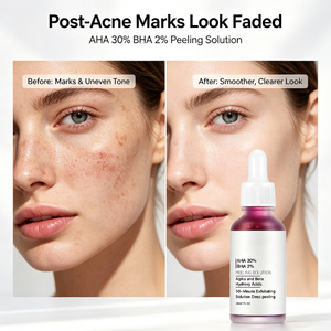 Productos para el Cuidado de la Piel con Logotipo Personalizado, Solución Exfoliante Arresal <span class=keywords><strong>AHA</strong></span> <span class=keywords><strong>BHA</strong></span>, Suero Facial con Ácido Salicílico, Suero Facial Blanqueador e Iluminador - Product Image 5