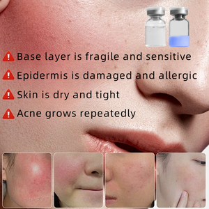 OEM 50mg Deep Repair Colágeno Skincare Peptídeos Liofilizados Cuidados Com A Pele Sensível Blue Ghk-cu <span class=keywords><strong>Copper</strong></span> Peptide Soro Antioxidante - Product Image 2