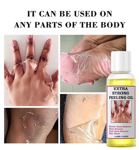 Huile exfoliante blanchissante à base de plantes pour le corps, les <span class=keywords><strong>jambes</strong></span>, les bras, éliminateur de taches brunes et de peau jaune sur les jointures - Product Image 4