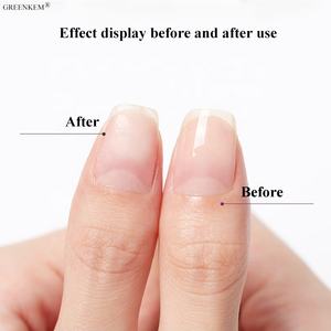 Aceite nutritivo para uñas, aceite nutritivo de árbol de té para la protección de las uñas, borde antivaho, exfoliación de la piel, reparación de cutículas dañadas - Product Image 3