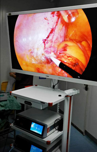 Equipo de Laparoscopia Shrek 4K UHD para Cirugía Ginecológica, Sistema de Endoscopia Completo para Torre de Laparoscopia - Product Image 2