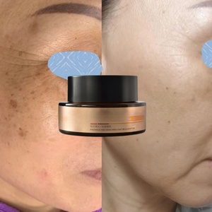 Crème de Traitement Anti-Pigmentation Effet Peeling <span class=keywords><strong>pour</strong></span> un Teint Unifié Idéale <span class=keywords><strong>pour</strong></span> le Visage Correcteur de Taches Brunes Effaceur Éclaircissant Éclat Anti-Mélasma - Product Image 4